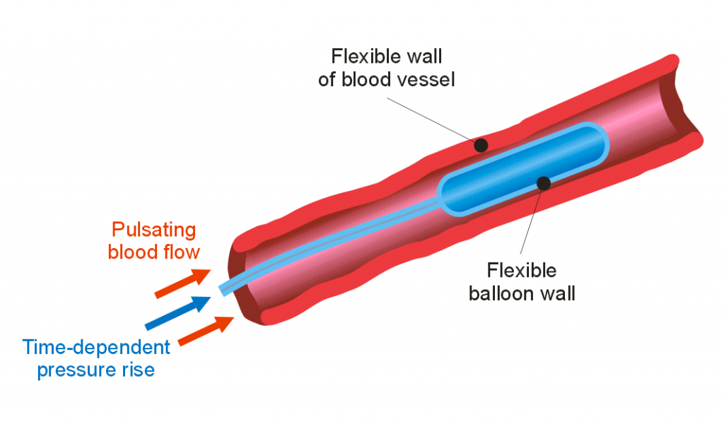 Fluid Structure Interaction ASD GmbH